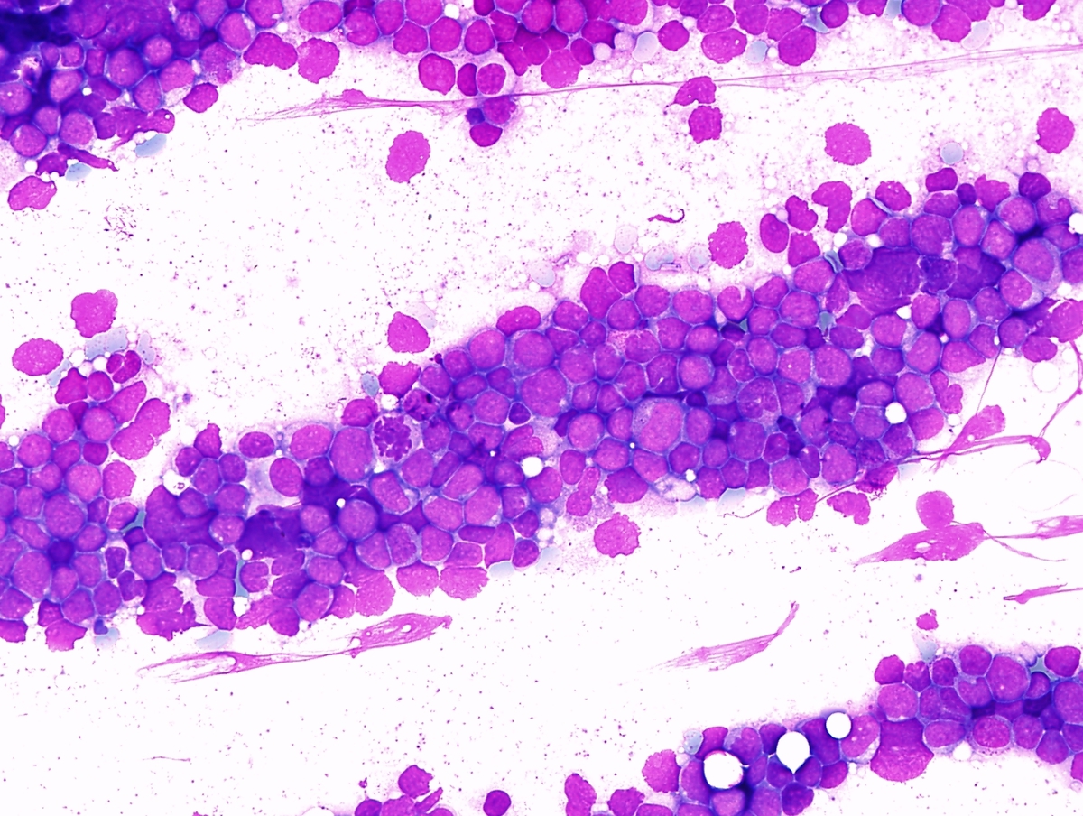 Intraoperative cytology, middle power